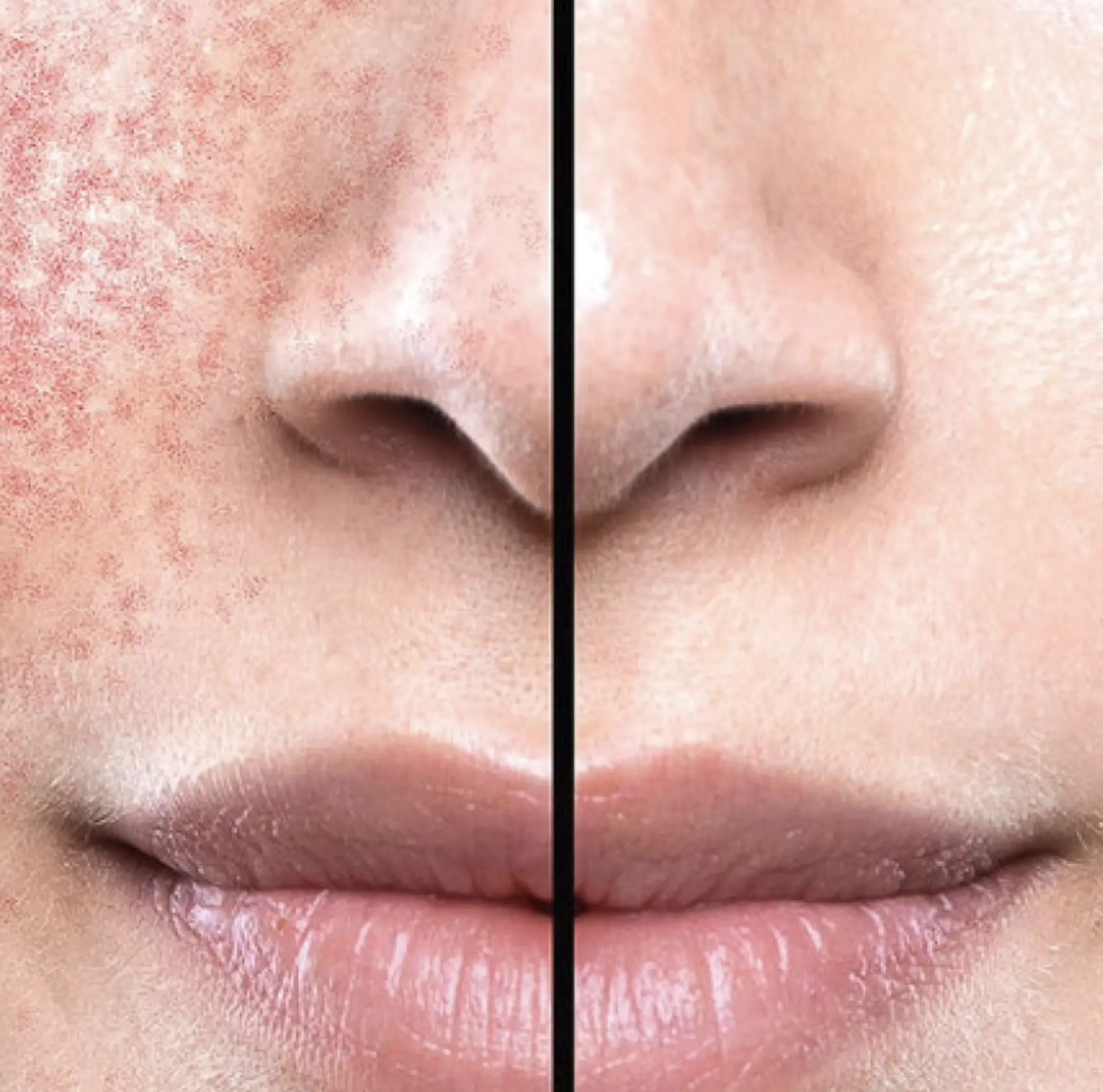 how to fix compromised skin barrier fast