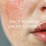 How To Heal Redness From A Damaged Skin Barrier?