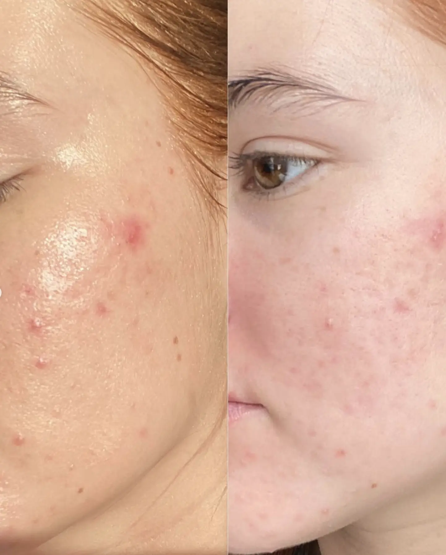 how to use actives in humid climate