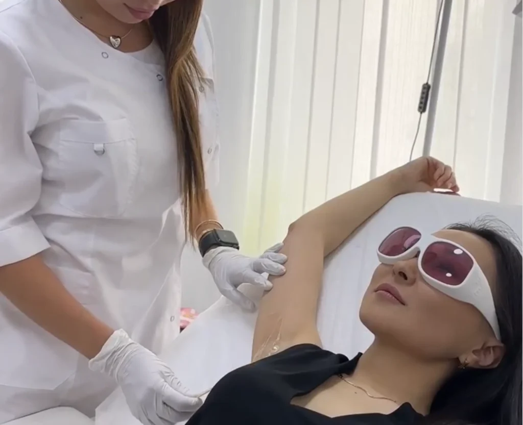 laser hair removal Melbourne