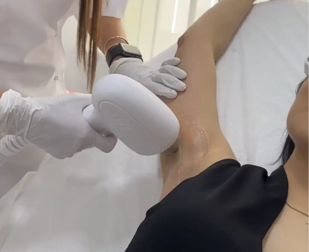 laser hair removal near me